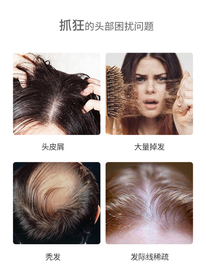 Peine de masaje para el cuero cabelludo, peine antiestático de iones negativos, peine de salud con masaje eléctrico de luz roja