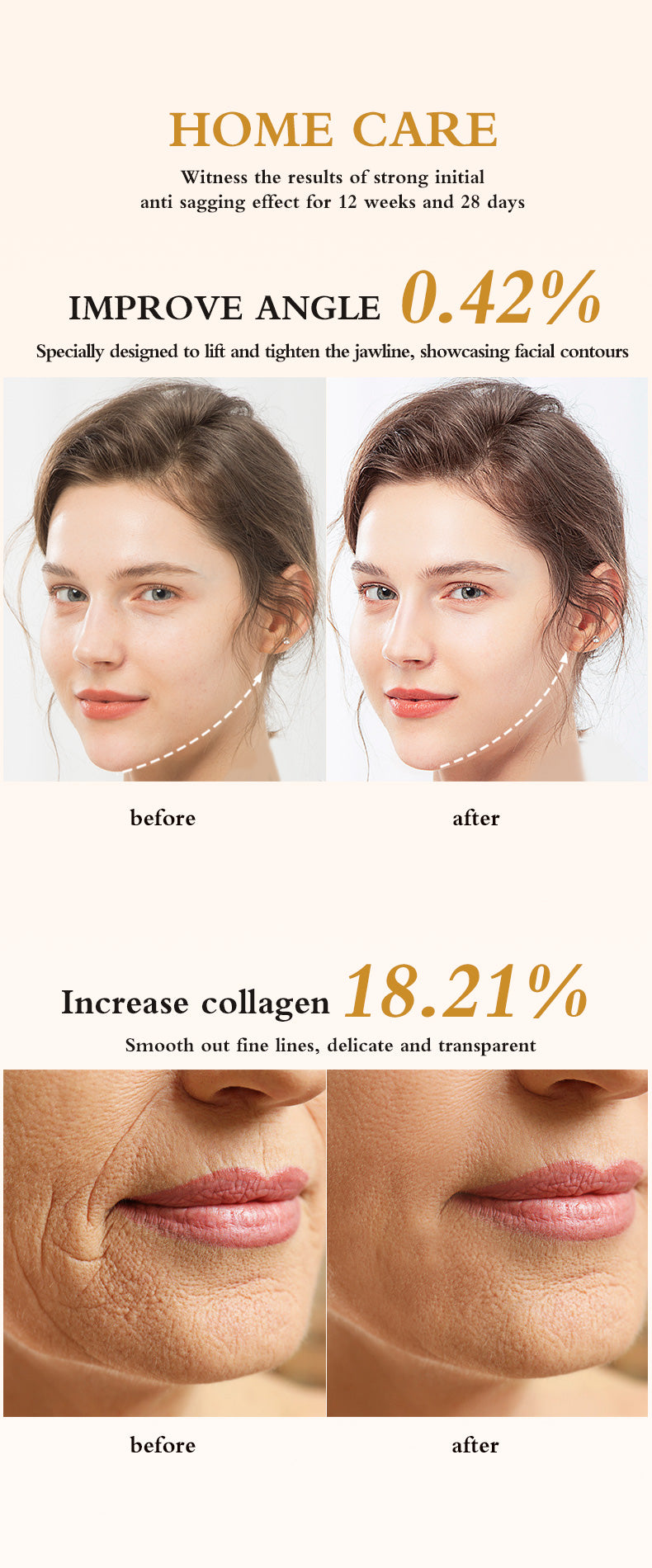 Lifting facial, modelado, reafirmante, masaje facial, introducción, aclaramiento, líneas finas, limpiador, lifting